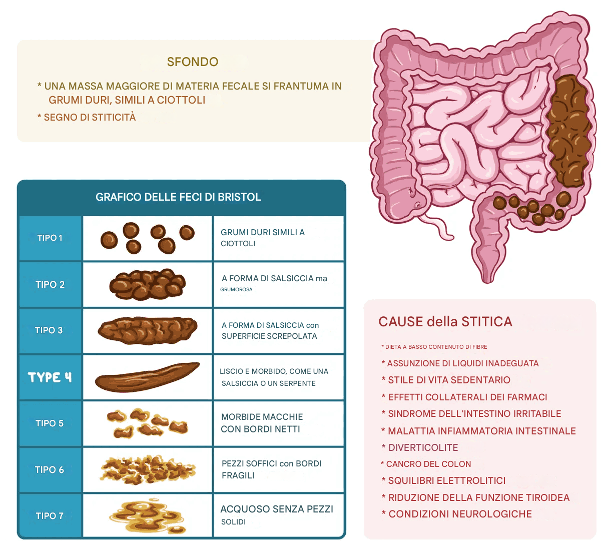 Feci simili a ciottoli: cosa sono, cause, trattamento